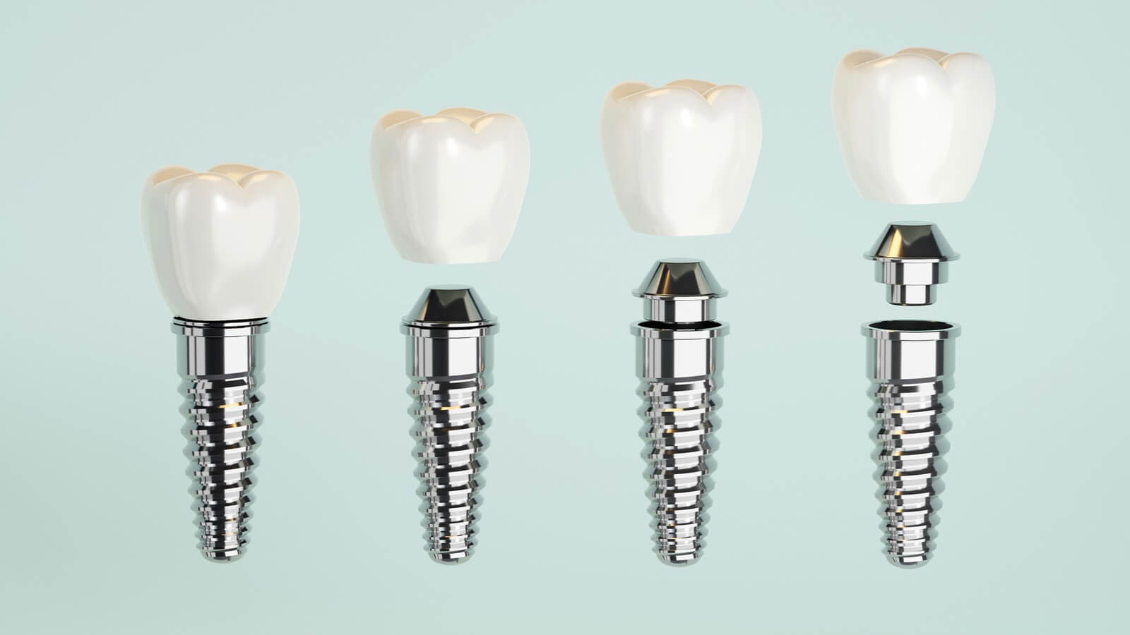 Conventional Annealing